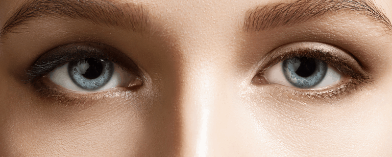 Хороидална неоваскуларизация