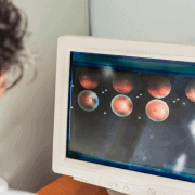 Макулна дегенерация – няколко важни въпроса