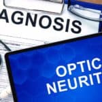 оптичен неврит