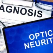 оптичен неврит