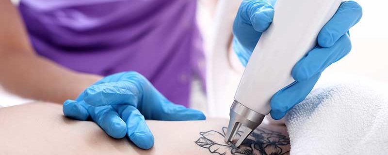 Риск от поява на увеит след поставяне на татуировка
